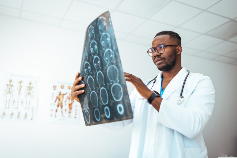 doctor-looking-at-brain-x-rays