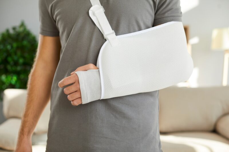 A man with a broken arm needs a Columbia personal injury lawyer.