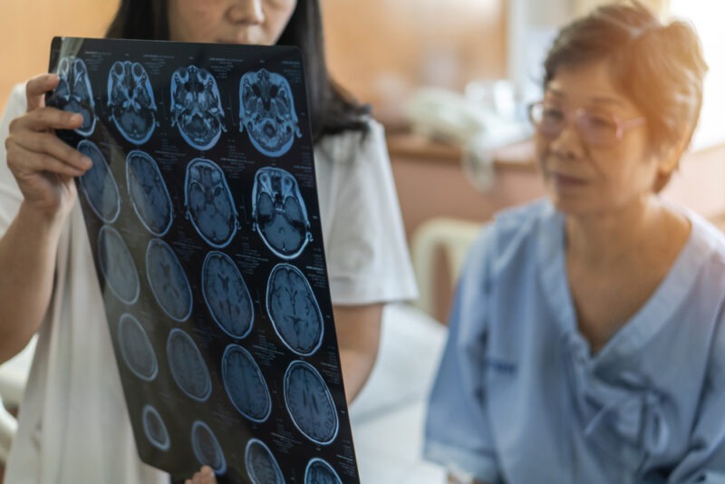 An injured woman looks at a chart and needs a Summerville traumatic brain injury lawyer.