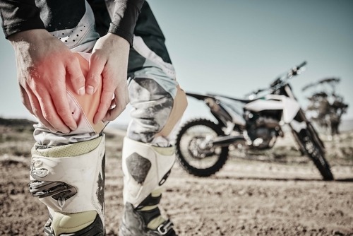 A motorcyclist holding an injured knee beside a dirt bike after a crash, illustrating injury claims handled by a Charleston motorcycle accident lawyer.